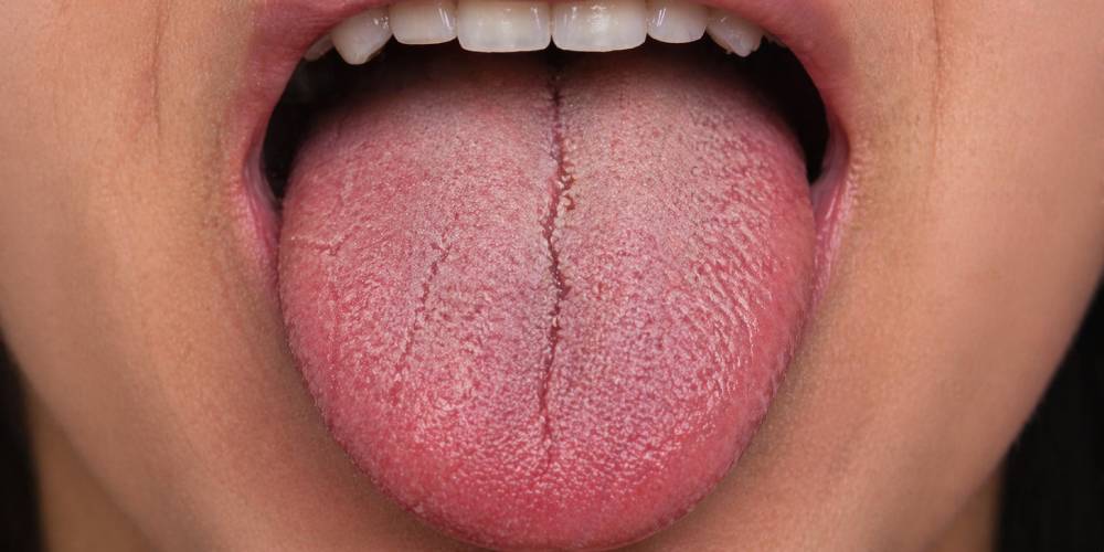 What Is Vaper's Tongue, Why It Happens, and How to Get Your Taste Back Fast