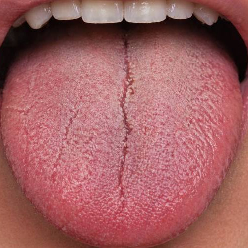 What Is Vaper's Tongue, Why It Happens, and How to Get Your Taste Back Fast